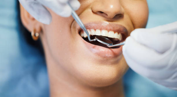 Best Emergency Wisdom Teeth Removal in Palmview, TX